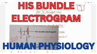 His Bundle Electrogram Bundle branch Block CVS [upl. by Oicul]