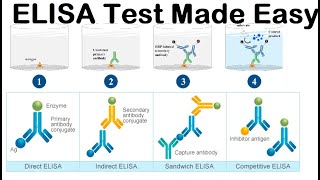 ELISA test HIV Test [upl. by Yla]