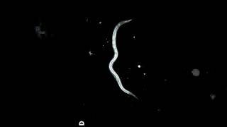 Nematode worm under microscope [upl. by Eintihw]