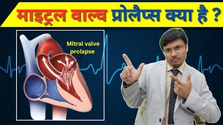 क्या आपके इको मे mitral valve prolapse आया है Understanding it  What is MVPmyxomatousvalve [upl. by Bradford306]