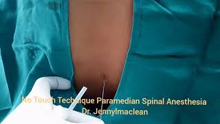 No Touch Technique Spinal Anesthesia by Paramedian Technique [upl. by Winnah]