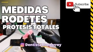 🤔CUÁNTO MIDEN ❓Los RODETES de CERA 👅 Prótesis TOTALES [upl. by Pazit939]