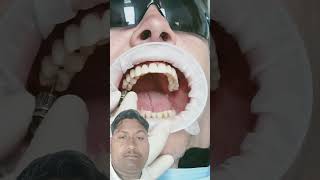 Dental Implants All on 4prague dentist teethwhitening smile short video [upl. by Avra787]