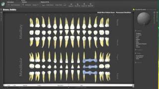 Odontogram Control in a sample UI [upl. by Gottfried398]