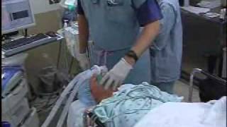 Bryan Hughes Corneal Transplant Surgery  PART 1 [upl. by Houghton586]