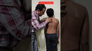 Treatment of Scoliosis scoliosis treatment spine explore trending chiropractic [upl. by Aleda]