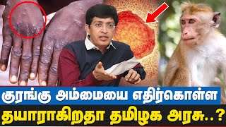 உலக நாடுகளில் பரவிவரும் குரங்கு அம்மை அடுத்து என்ன  Monkeypox cases confirmed in several countries [upl. by Reinhart]