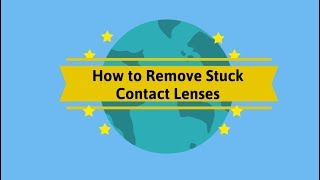 How to Remove Stuck Contact Lens  Easily [upl. by Taddeusz37]