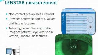 Optimal Cataract Workflow with HaagStreit LENSTAR and SMI Surery Guidance [upl. by Ahsas]