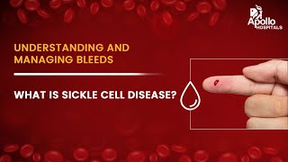 Apollo Hospitals  What is sickle cell disease  Dr Gaurav Kharya [upl. by Sykes28]