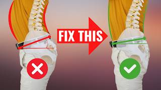 FIX Anterior Pelvic Tilt in 100 Seconds for PERFECT Posture [upl. by Areval847]