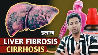 ❎ लीवर ✅ liver cirrhosis  liver fibrosis  Treatment [upl. by Lodge]