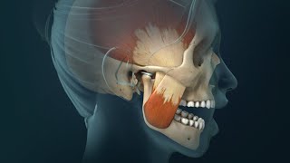 TMJ Pain Headaches Earaches and Spasms [upl. by Eilzel481]