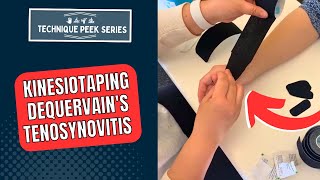 Kinesiotaping Technique for Treatment of DeQuervains Tenosynovitis  Technique Peek Series [upl. by Atteras]