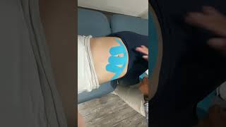 Kinesiology taping for pregnancy related pain [upl. by Odraboel477]