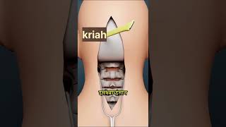 How Brain Clot Is Removed 3D Animation shorts [upl. by Alam]