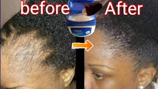 I used Vaseline and Coffee on my hair for 1 month after haircut  Vaseline for hair growth [upl. by Yeldua]