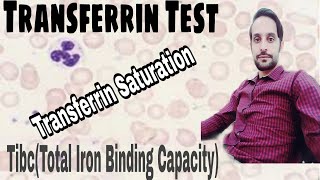 Transferrin Test  TIBC  Transferrin Saturation [upl. by Eidob]