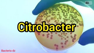 Citrobacter freundiiPantoea spp 1klebsiella pneumoniae ssp pneumoniae Enterobacter cloaceae [upl. by Htirehc]