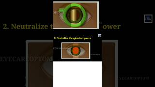 Easy 3 step Retinoscopy  Optometrist eyecareoptom shorts short optometry retinoscopy [upl. by Garbers]