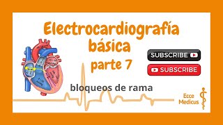 Electrocardiografía básica 7  Bloqueo de rama [upl. by Aikkin40]