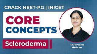 Medico Core Concepts Scleroderma Dr Raveerna [upl. by Anavahs]