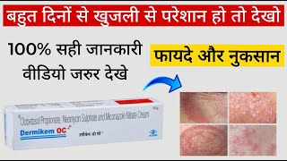 Dermikem OC Cream Review in hindi  dermikem Cream  कैसे लगाये  फायदे और नुकसान [upl. by Ecidnac916]