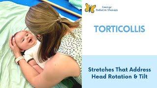 Torticollis 2 Stretches To Try At Home [upl. by Rigdon]