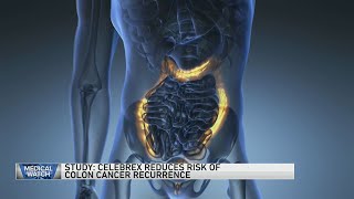 Study Celebrex reduces risk of colon cancer recurrence — and more [upl. by Eirot]