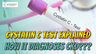 Serum Cystatin C Test To Diagnose Chronic Kidney Disease  CKD Testing [upl. by Limann]