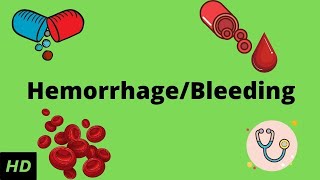 Hemorrhage bleeding Causes Signs and Symptoms Diagnosis and Treatment [upl. by Eiramik930]