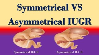 Symmetrical and Asymmetrical IUGR Differences  Symmetrical Vs Asymmetrical IUGR [upl. by Ahsele]