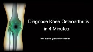 Diagnose Knee Osteoarthritis in 4 Minutes with Leslie Nielsen [upl. by Ariamo576]