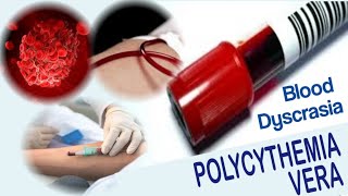 Polycythemia Vera  Blood Dyscrasia  Causes Symptoms Diagnosis and Treatment [upl. by Niriam]