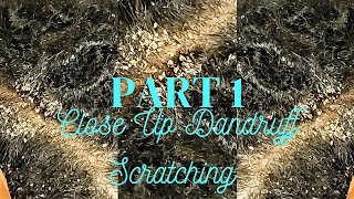 Im Back  Close Up Dandruff Scratching  Part 1 No Talking  055 [upl. by Euqinotna]