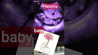 Placenta in pregnancy whats Placenta shortvideo [upl. by Latoya474]