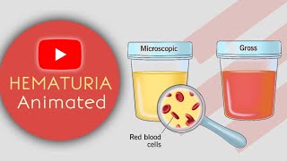 Hematuria  Blood in Urine in Easy  Animated [upl. by Leiand]