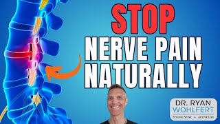 Nerve Pain Relief What Actually Works For Radiculopathy [upl. by Borries]