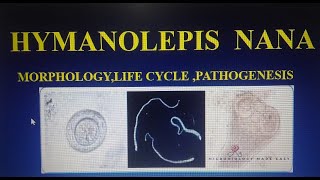 HYMENOLEPIS NANADWARF TAPE WORMMORPHOLOGY LIFECYCLE amp PATHOGENESIS [upl. by Sidhu71]