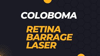 COLOBOMA  BARRAGE LASER retina [upl. by Culley]