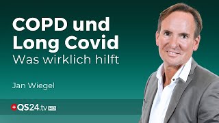 Stammzellen in der Bekämpfung von COPD und Long Covid  Erfahrungsmedizin  QS24 [upl. by Service]