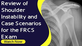 Review of Shoulder Instability and Case Scenarios for the FRCS Exam  Orthopaedic Academy [upl. by Leuams998]