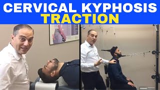 Cervical Kyphosis Traction Corrective Chiropractic Care  Dr Walter Salubro [upl. by Eugor]