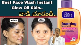 Clean Clear Best Face Wash  For Oily Skin and glowing skincare [upl. by Kall]