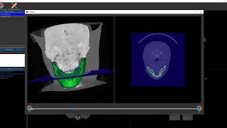 Deep learning CT segmentation application demo [upl. by Babcock]