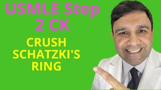 USMLE Step 2 CK score 270 series  Schatzkis ring [upl. by Wernda]