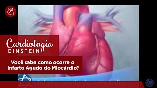 Você sabe como ocorre o Infarto Agudo do Miocárdio [upl. by Ignace]