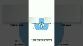 Electrical Cardioversion cardioversion cardiology heart arrhythmia surgmedia [upl. by Aym275]