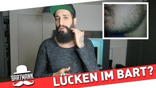 Lücken im Bart  Was tun BARTMANN [upl. by Nylirrej]