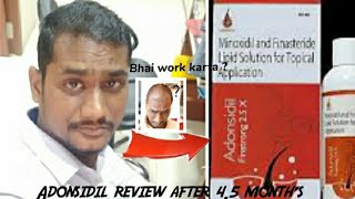 Adonsidil Finstrong 25 X review after using for 45 months Best hai ya waste hai [upl. by Hercules]